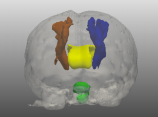 Regions of interest in a brain